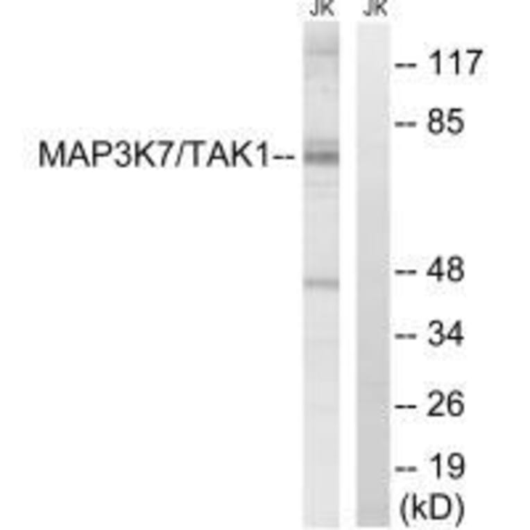 Western blot - MAP3K7 (Ab-187) Antibody from Signalway Antibody (33234) - Antibodies.com