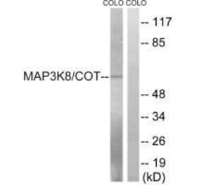 Western blot - MAP3K8 (Ab-400) Antibody from Signalway Antibody (33235) - Antibodies.com