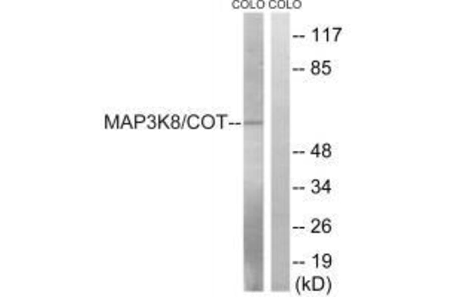 Western blot - MAP3K8 (Ab-400) Antibody from Signalway Antibody (33235) - Antibodies.com