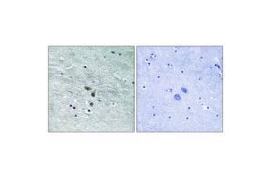 Immunohistochemistry - MAP3K8 (Ab-400) Antibody from Signalway Antibody (33235) - Antibodies.com