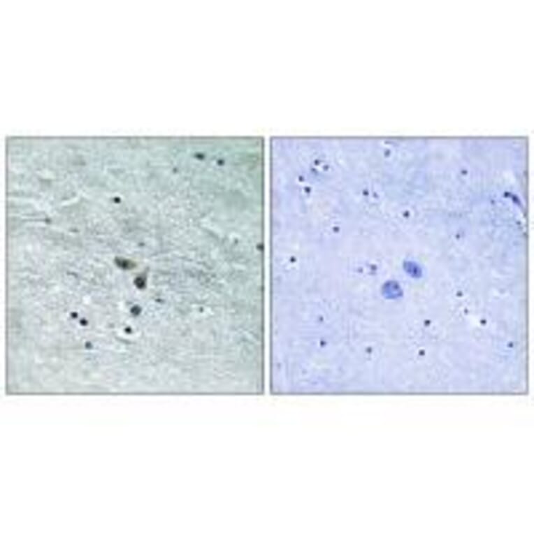 Immunohistochemistry - MAP3K8 (Ab-400) Antibody from Signalway Antibody (33235) - Antibodies.com