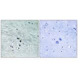 Immunohistochemistry - MAP3K8 (Ab-400) Antibody from Signalway Antibody (33235) - Antibodies.com