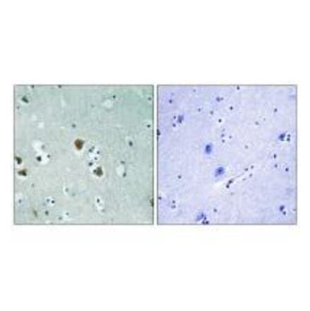Immunohistochemistry - CRMP-2 (Ab-509) Antibody from Signalway Antibody (33280) - Antibodies.com