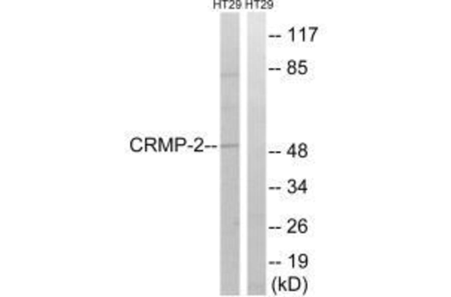 Western blot - CRMP-2 (Ab-509) Antibody from Signalway Antibody (33280) - Antibodies.com