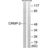 Western blot - CRMP-2 (Ab-509) Antibody from Signalway Antibody (33280) - Antibodies.com