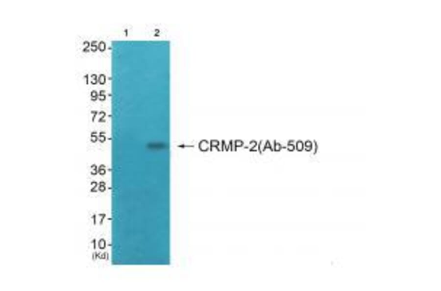 Western blot - CRMP-2 (Ab-509) Antibody from Signalway Antibody (33280) - Antibodies.com