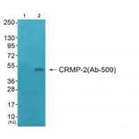Western blot - CRMP-2 (Ab-509) Antibody from Signalway Antibody (33280) - Antibodies.com