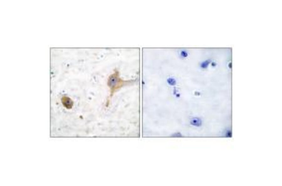 Immunohistochemistry - GABA B Receptor Antibody from Signalway Antibody (33378) - Antibodies.com