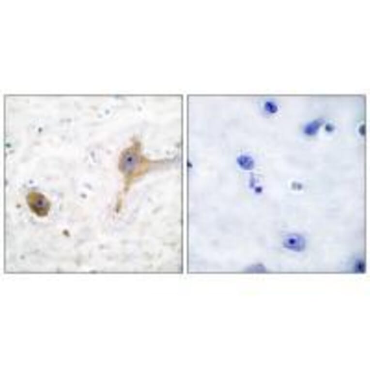 Immunohistochemistry - GABA B Receptor Antibody from Signalway Antibody (33378) - Antibodies.com