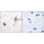 Immunohistochemistry - GABA B Receptor Antibody from Signalway Antibody (33378) - Antibodies.com