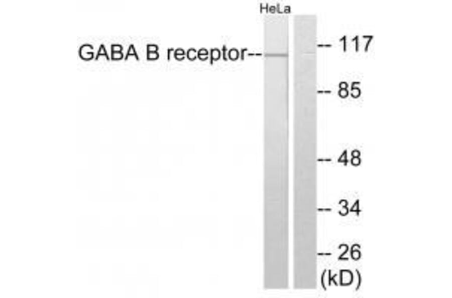 Western blot - GABA B Receptor Antibody from Signalway Antibody (33378) - Antibodies.com