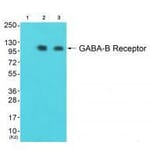 Western blot - GABA B Receptor Antibody from Signalway Antibody (33378) - Antibodies.com