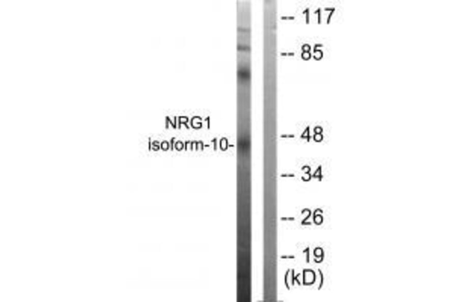 Western blot - NRG1 isoform-10 Antibody from Signalway Antibody (33404) - Antibodies.com