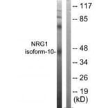 Western blot - NRG1 isoform-10 Antibody from Signalway Antibody (33404) - Antibodies.com