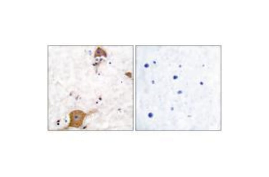 Immunohistochemistry - NRG1 isoform-10 Antibody from Signalway Antibody (33404) - Antibodies.com