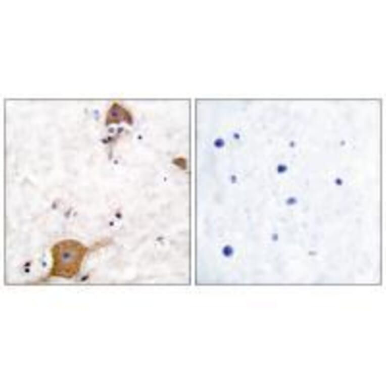 Immunohistochemistry - NRG1 isoform-10 Antibody from Signalway Antibody (33404) - Antibodies.com