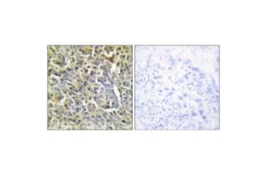 Immunohistochemistry - Collagen VI α2 Antibody from Signalway Antibody (34208) - Antibodies.com