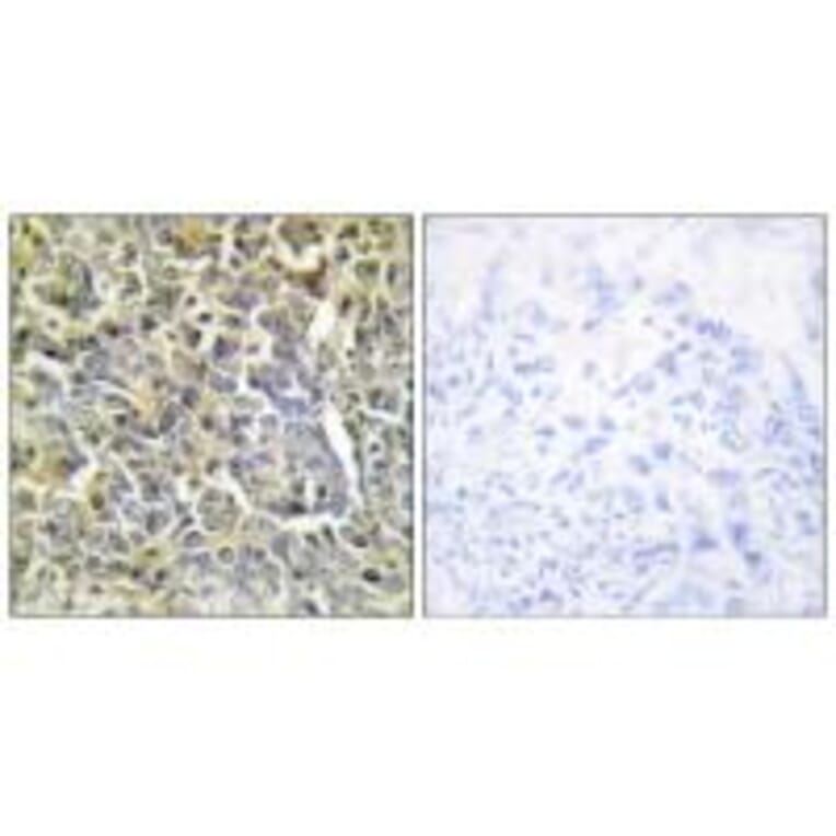 Immunohistochemistry - Collagen VI α2 Antibody from Signalway Antibody (34208) - Antibodies.com