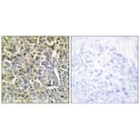 Immunohistochemistry - Collagen VI α2 Antibody from Signalway Antibody (34208) - Antibodies.com