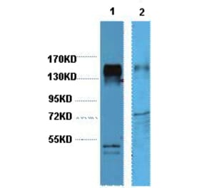 Western blot - HER2 Monoclonal Antibody from Signalway Antibody (40419) - Antibodies.com