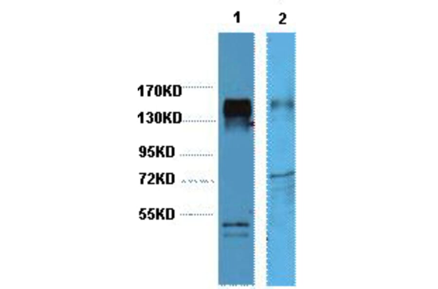 Western blot - HER2 Monoclonal Antibody from Signalway Antibody (40419) - Antibodies.com