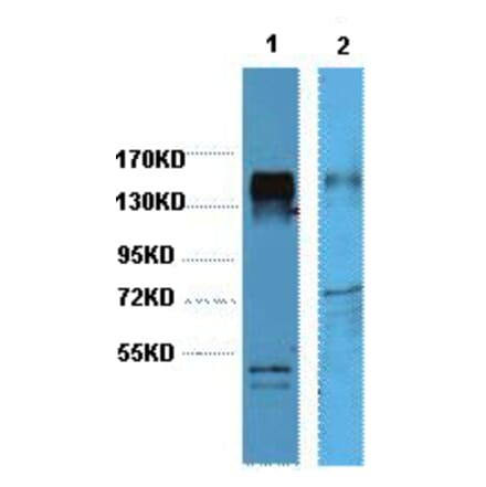 Western blot - HER2 Monoclonal Antibody from Signalway Antibody (40419) - Antibodies.com
