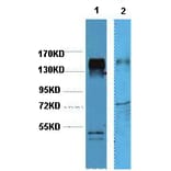 Western blot - HER2 Monoclonal Antibody from Signalway Antibody (40419) - Antibodies.com