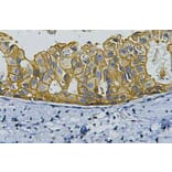 HER2 Monoclonal Antibody from Signalway Antibody (40419) - Antibodies.com