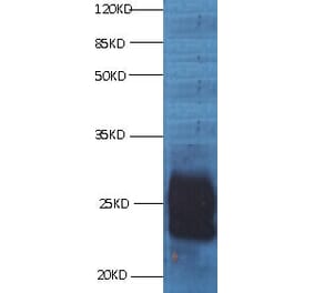 CD59 Monoclonal Antibody from Signalway Antibody (42018) - Antibodies.com