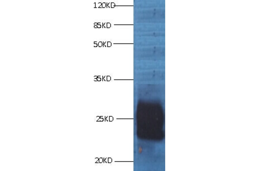 CD59 Monoclonal Antibody from Signalway Antibody (42018) - Antibodies.com