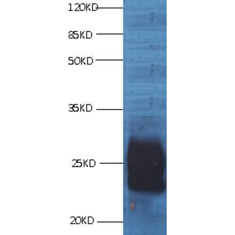 CD59 Monoclonal Antibody from Signalway Antibody (42018) - Antibodies.com