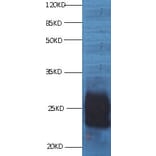 CD59 Monoclonal Antibody from Signalway Antibody (42018) - Antibodies.com