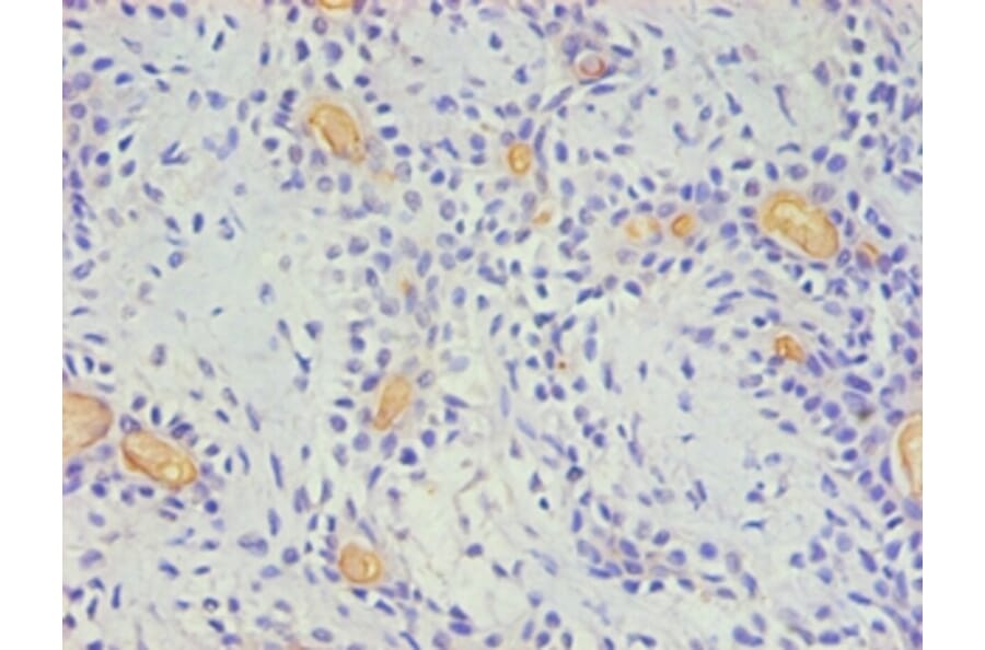 Immunohistochemistry - CD59 Monoclonal Antibody from Signalway Antibody (42018) - Antibodies.com