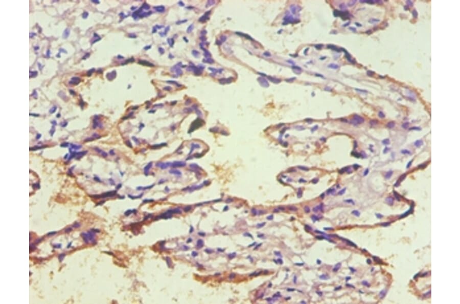 Immunohistochemistry - CD59 Monoclonal Antibody from Signalway Antibody (42018) - Antibodies.com