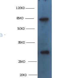 TGM2 Monoclonal Antibody from Signalway Antibody (42029) - Antibodies.com