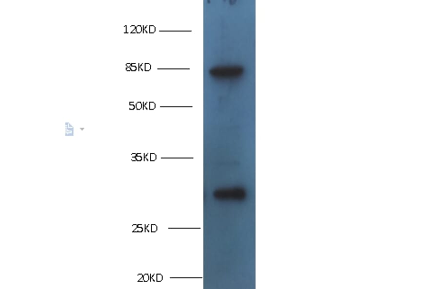 TGM2 Monoclonal Antibody from Signalway Antibody (42029) - Antibodies.com