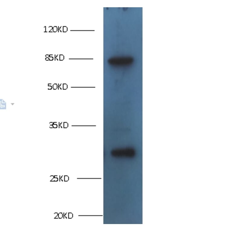 TGM2 Monoclonal Antibody from Signalway Antibody (42029) - Antibodies.com