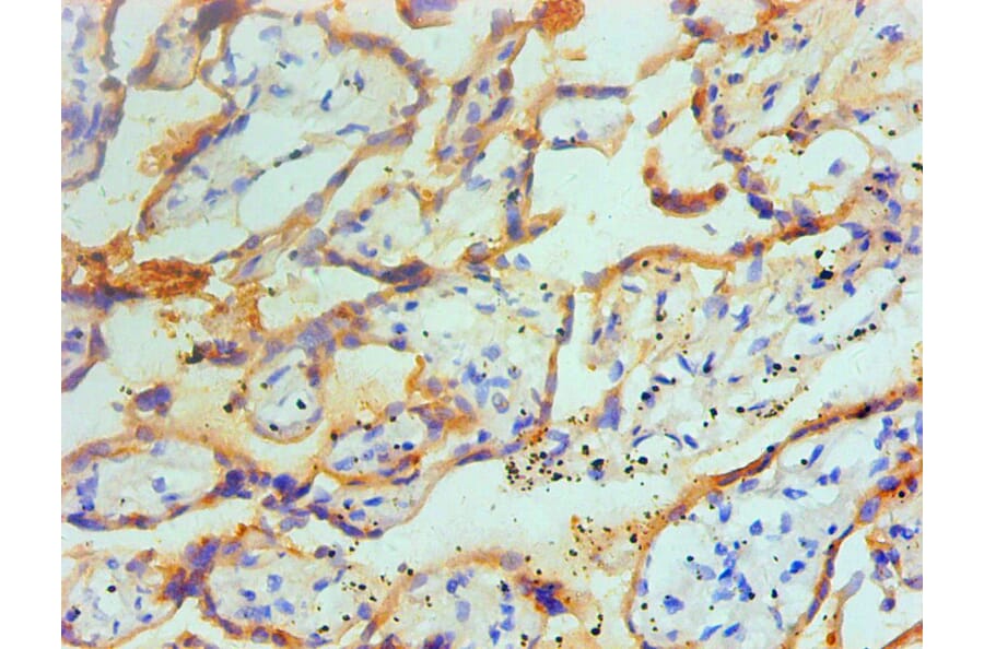 Immunohistochemistry - TGM2 Monoclonal Antibody from Signalway Antibody (42029) - Antibodies.com