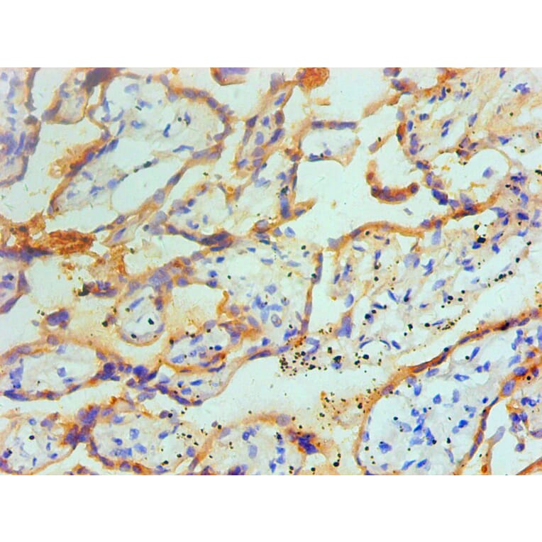 Immunohistochemistry - TGM2 Monoclonal Antibody from Signalway Antibody (42029) - Antibodies.com