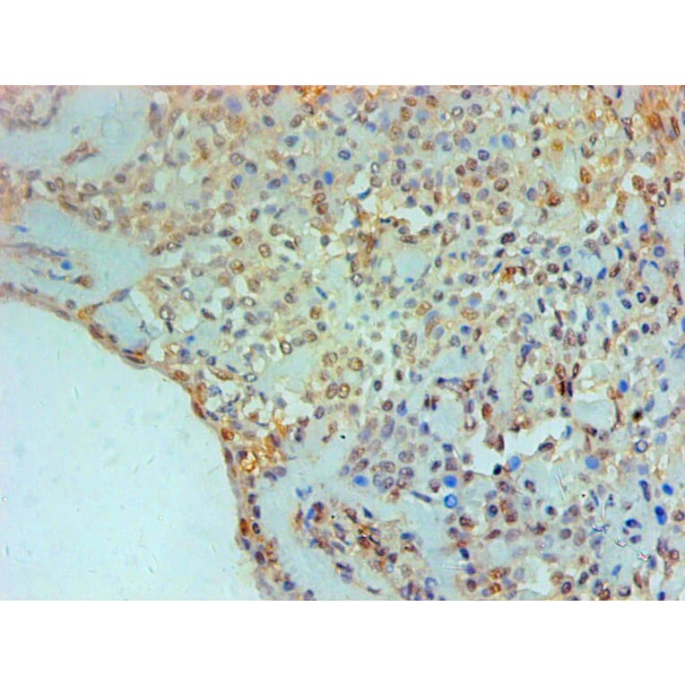 Immunohistochemistry - TGM2 Monoclonal Antibody from Signalway Antibody (42029) - Antibodies.com