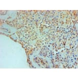 Immunohistochemistry - TGM2 Monoclonal Antibody from Signalway Antibody (42029) - Antibodies.com