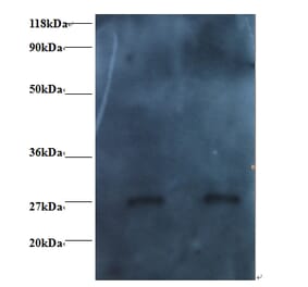 RBP4 Monoclonal Antibody from Signalway Antibody (42037) - Antibodies.com