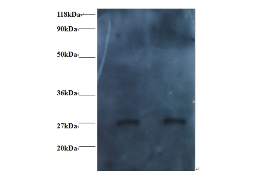 RBP4 Monoclonal Antibody from Signalway Antibody (42037) - Antibodies.com