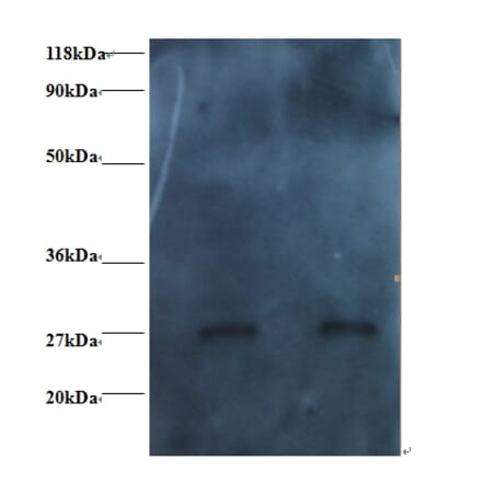 RBP4 Monoclonal Antibody from Signalway Antibody (42037) - Antibodies.com
