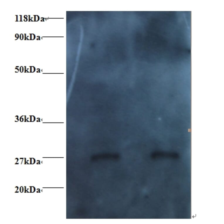 RBP4 Monoclonal Antibody from Signalway Antibody (42037) - Antibodies.com