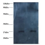 RBP4 Monoclonal Antibody from Signalway Antibody (42037) - Antibodies.com