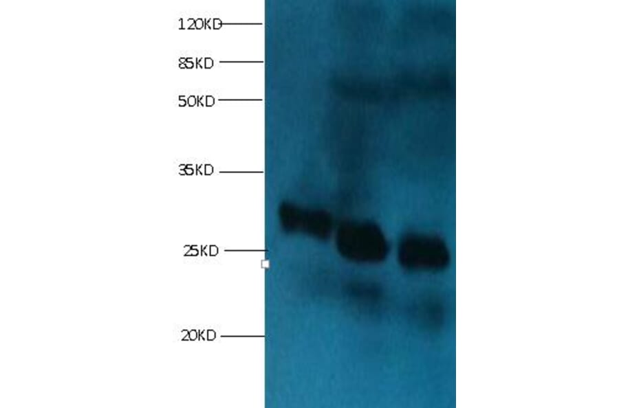 RBP4 Monoclonal Antibody from Signalway Antibody (42037) - Antibodies.com