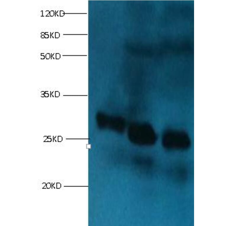 RBP4 Monoclonal Antibody from Signalway Antibody (42037) - Antibodies.com