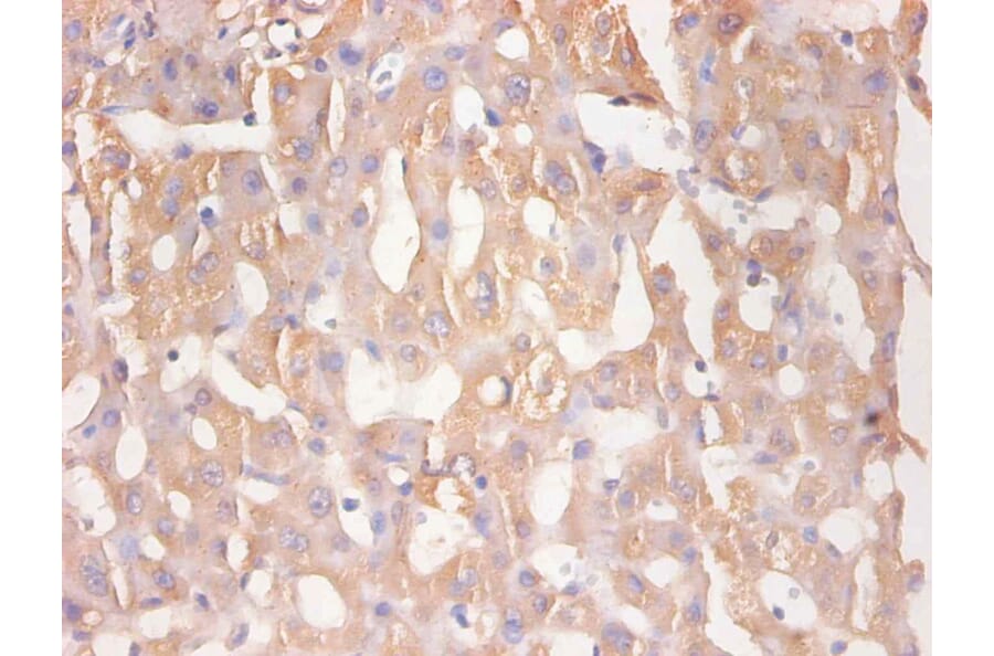 Immunohistochemistry - RBP4 Monoclonal Antibody from Signalway Antibody (42037) - Antibodies.com
