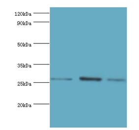 AZU1 Polyclonal Antibody from Signalway Antibody (42077) - Antibodies.com